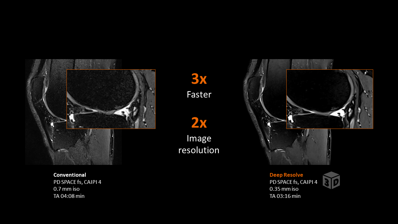 MRI – Knie-Untersuchung