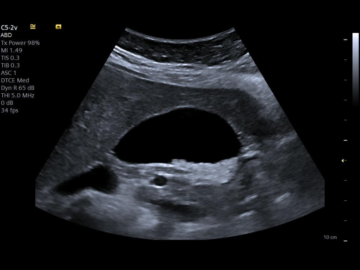 Ultraschall – Optimierte Bildgebung