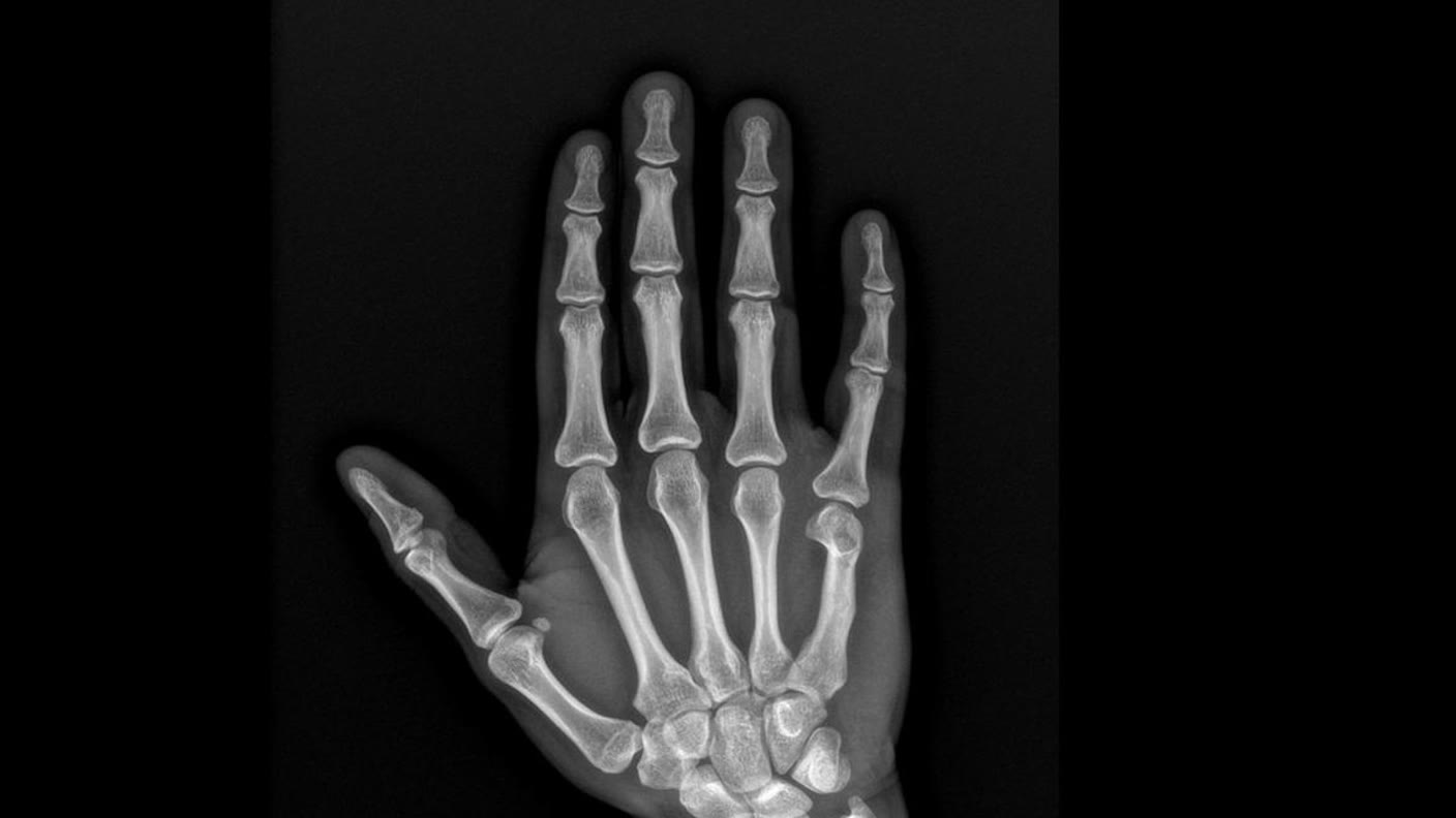Digitales Röntgen – Handaufnahme